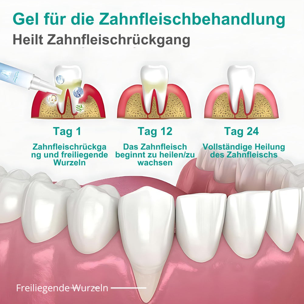 Teeth Repair Gel revitaliserer og blegner tænderne allerede efter den første uge.